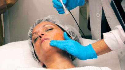 3.-TRATAMIENTO-MELASMA-DE-ORIGEN-VASCULAR-redimensionada