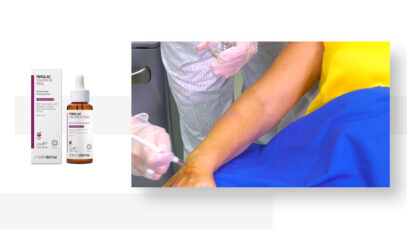 CLINICA-TRAT-DR-FERULAC-V-PEEL-PLAY