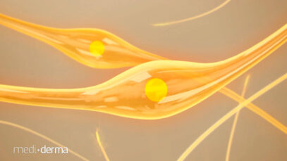 PEELINGS-redimensionada