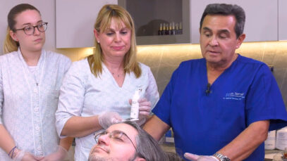 PRP-CON-MICRONEEDLING-PLAY