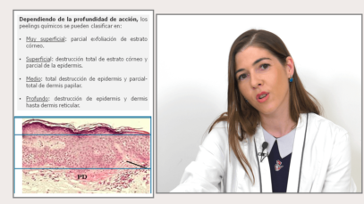 QUE-ES-UN-PEELING-QUIMICO